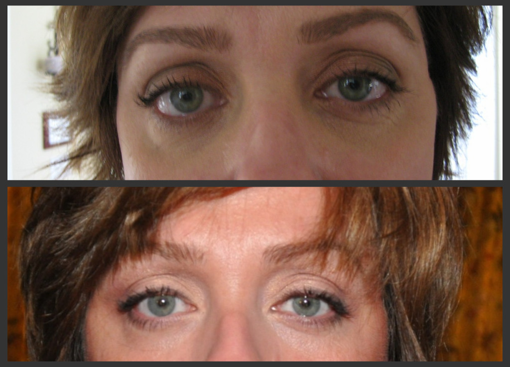 Before and after1