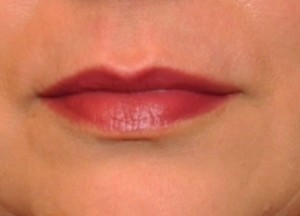 Finished lip
