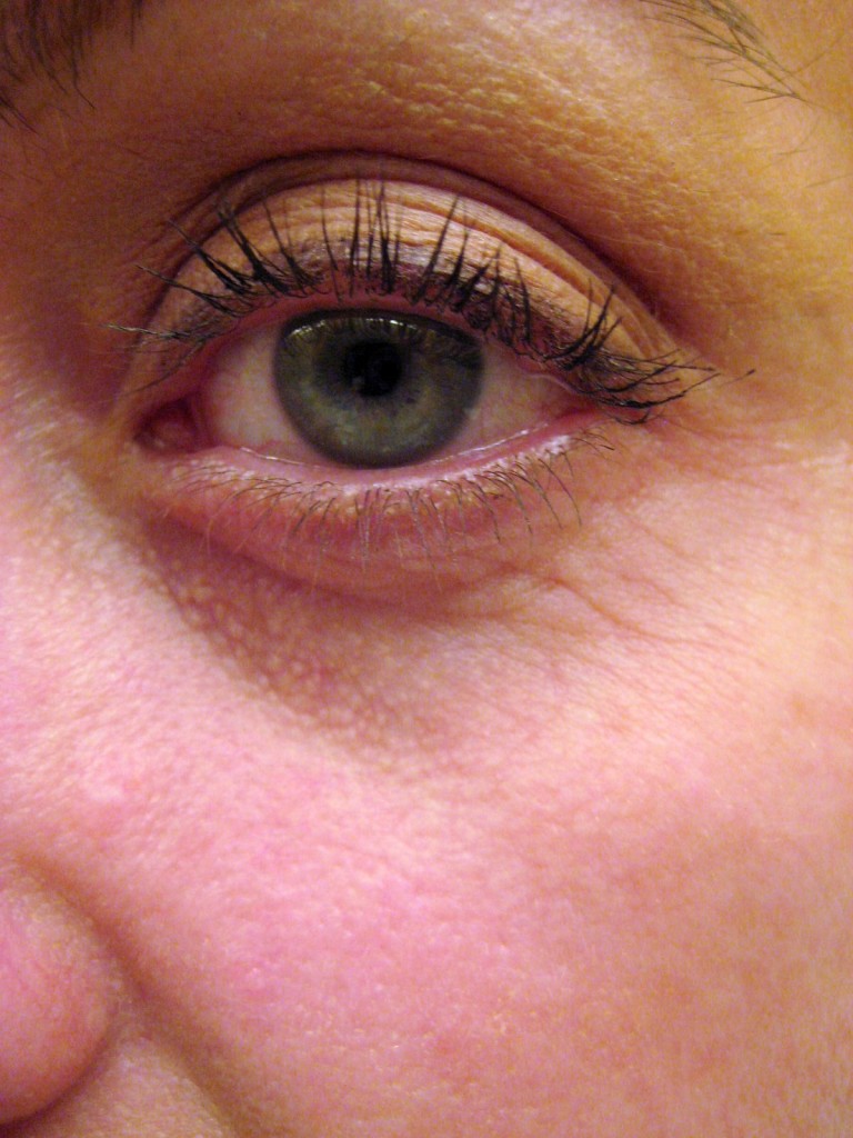 Before Clarisonic Opal