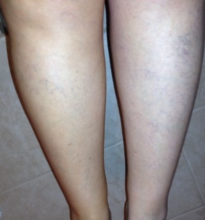 Legs